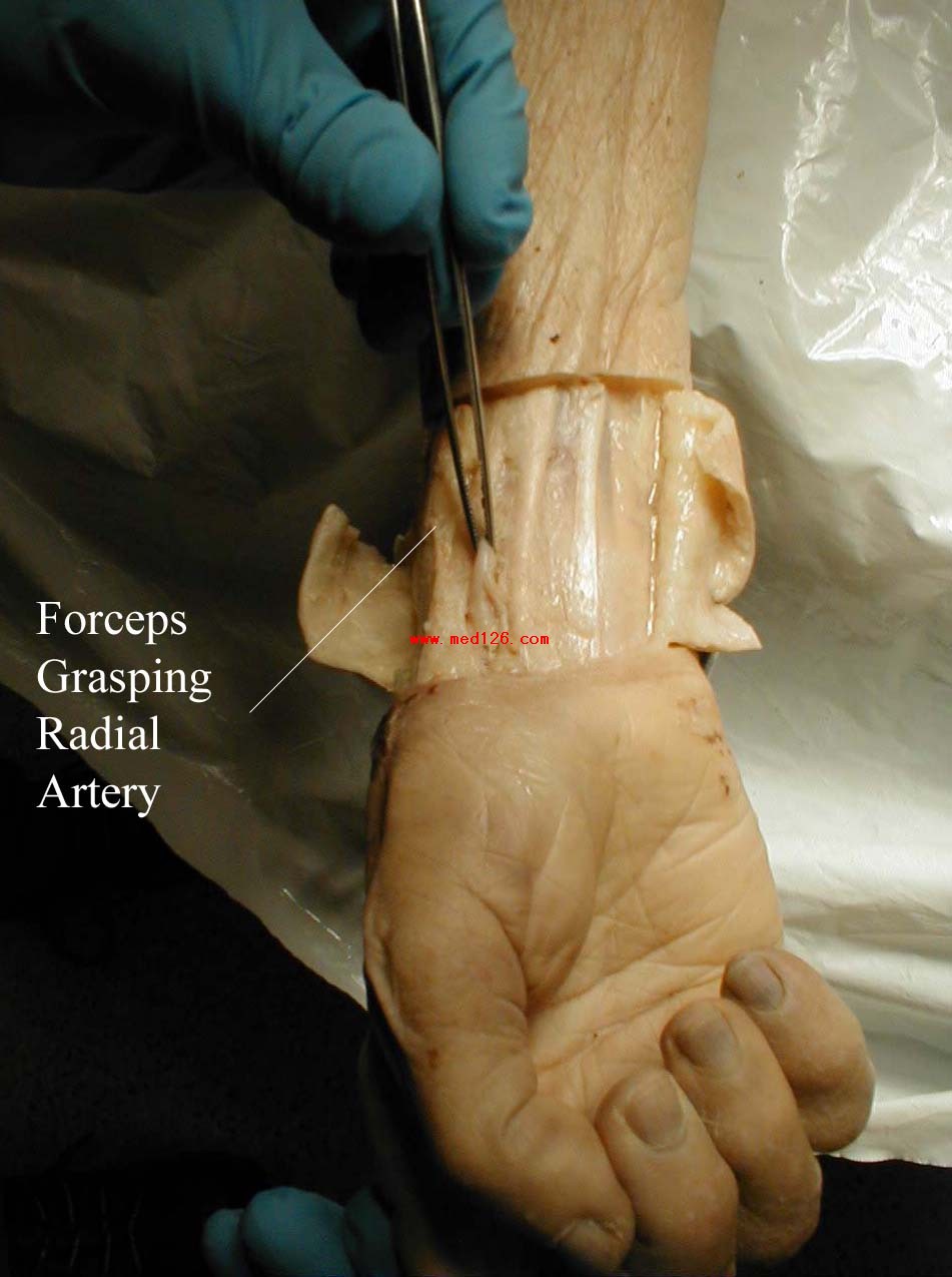 normal radial anatomy